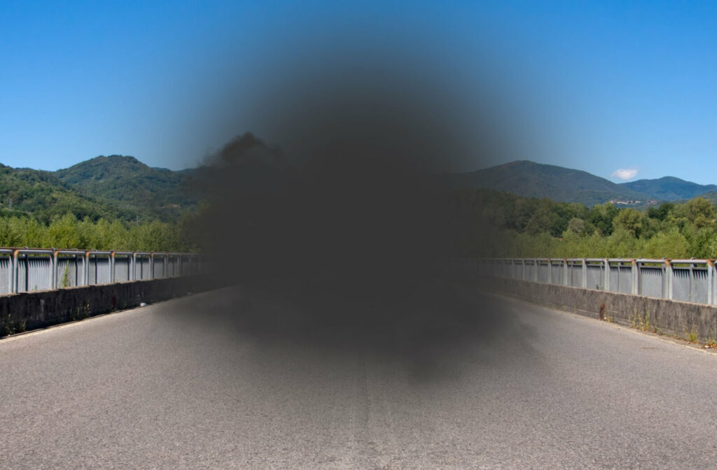 A sample image of a person with macular degeneration, a blurred or no vision in the center of the visual field.