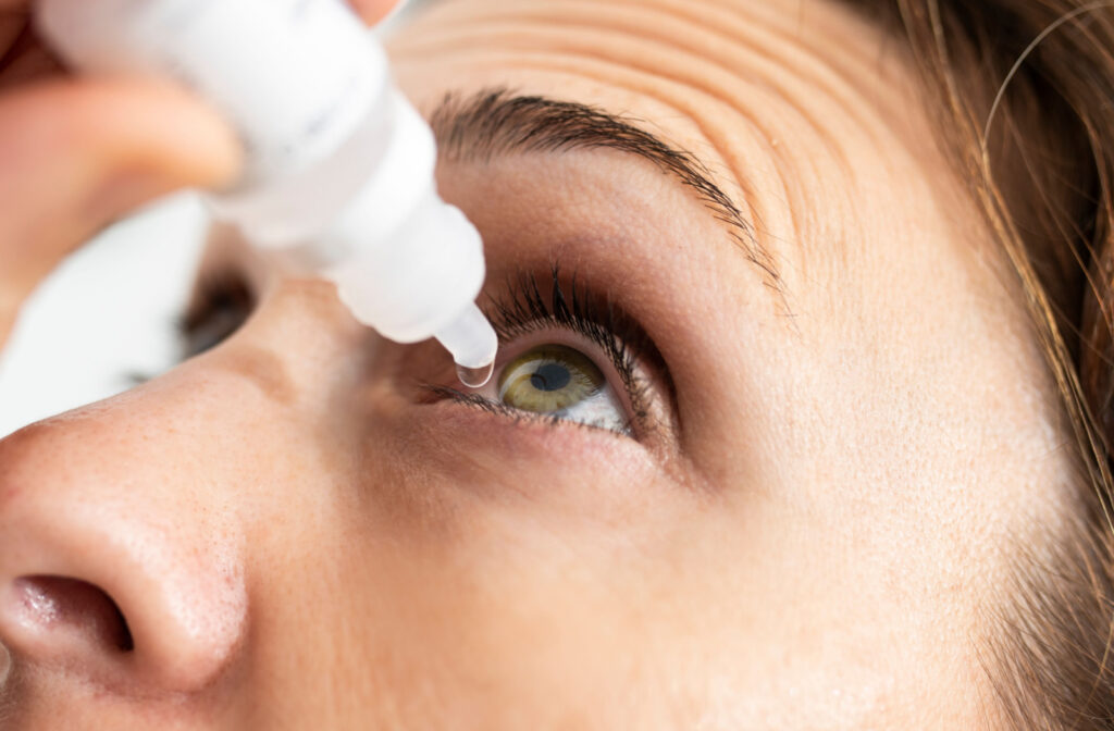 A person administering eye drops to help lubricate the eye and lessen the effects of dry eye and light sensitivity.