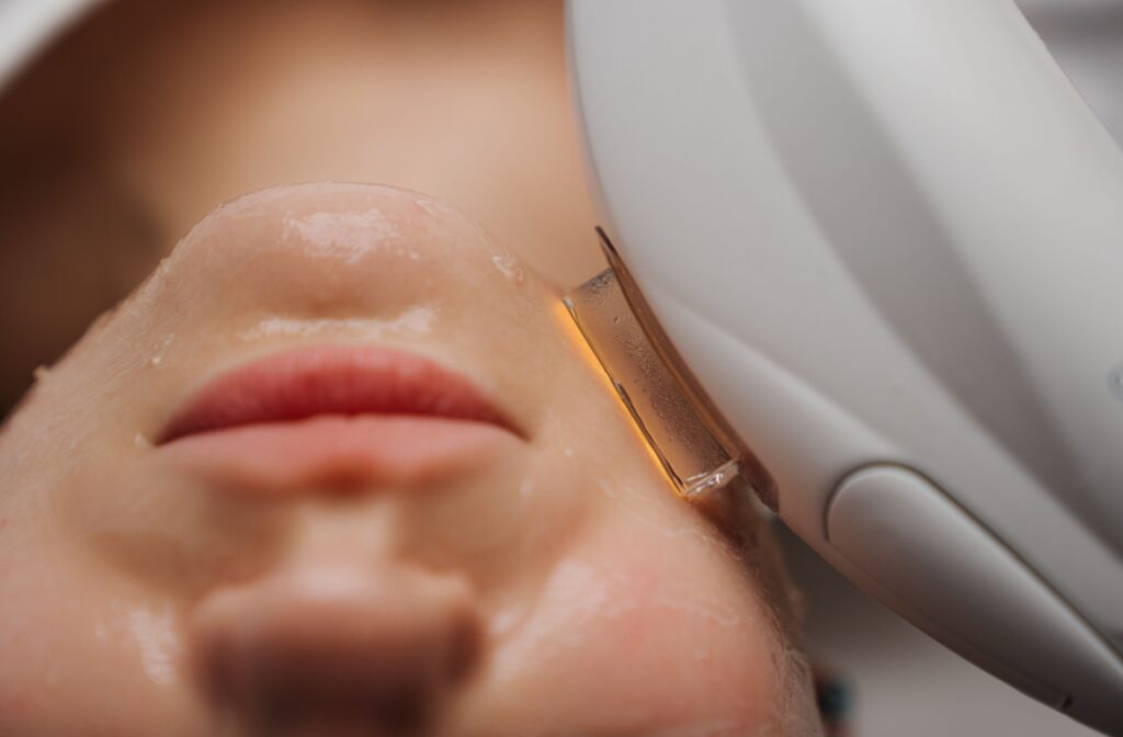 A closeup of a young woman undergoing her IPL photofacial treatment.