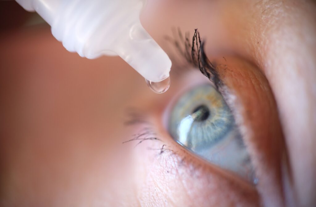 Close-up image of a patient applying lubricating eye drops to relieve symptoms of dry eye.